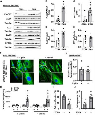 Akt-Dependent Glycolysis-Driven Lipogenesis Supports Proliferation and Survival of Human Pulmonary Arterial Smooth Muscle Cells in Pulmonary Hypertension